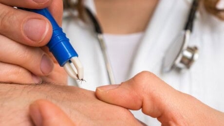 What does a tick bite look like