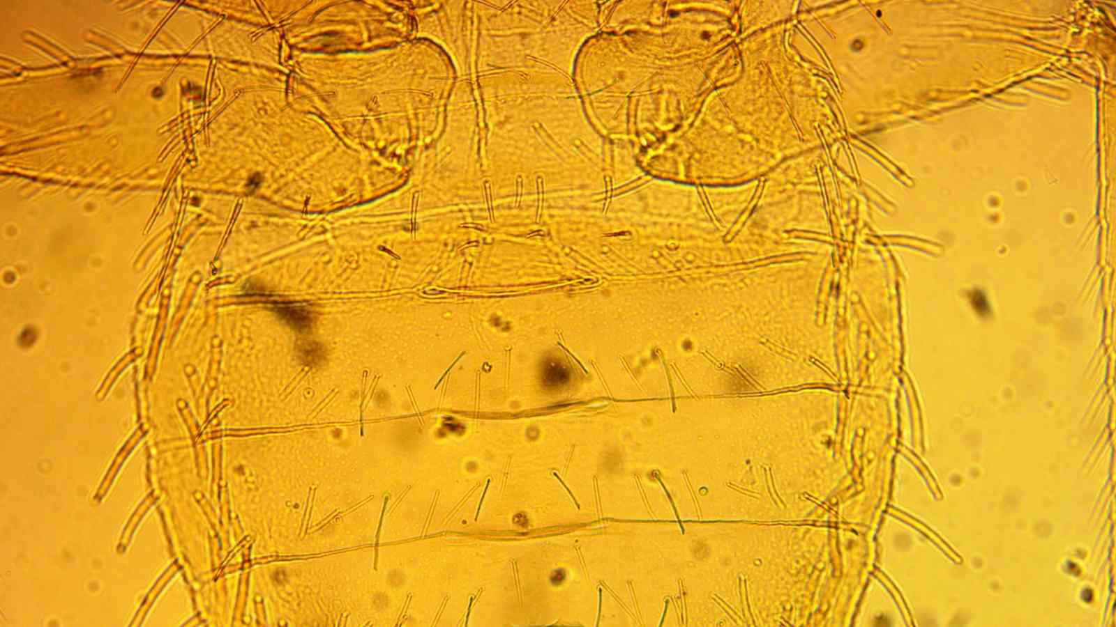 Abdomen of a bed bug under a microscope